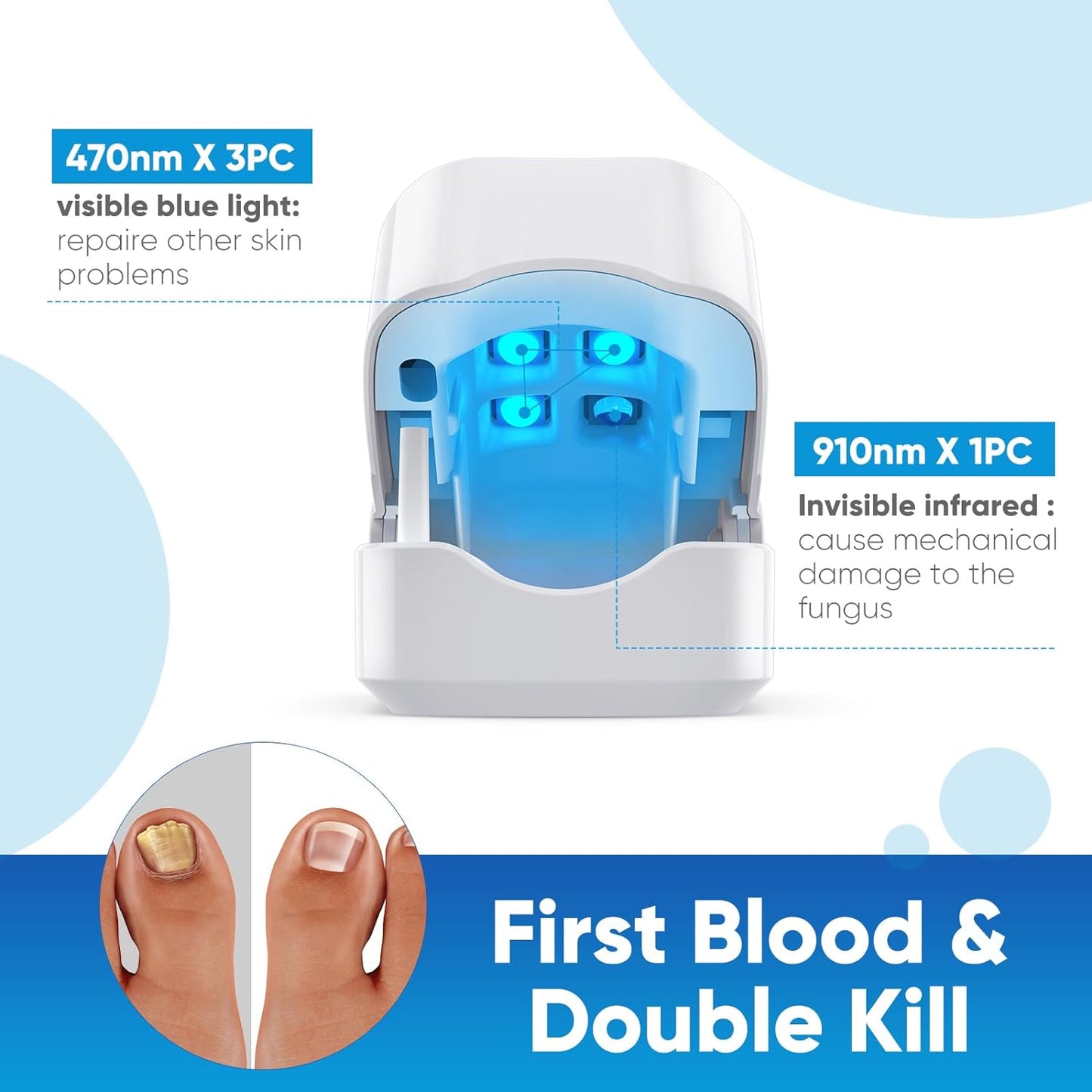UUC Nail Fungus Cleaning Laser Treatment Device, Nail Fungus Treatment for Toenails,Advanced Light Device, Used Anytime Anywhere for Compact Product