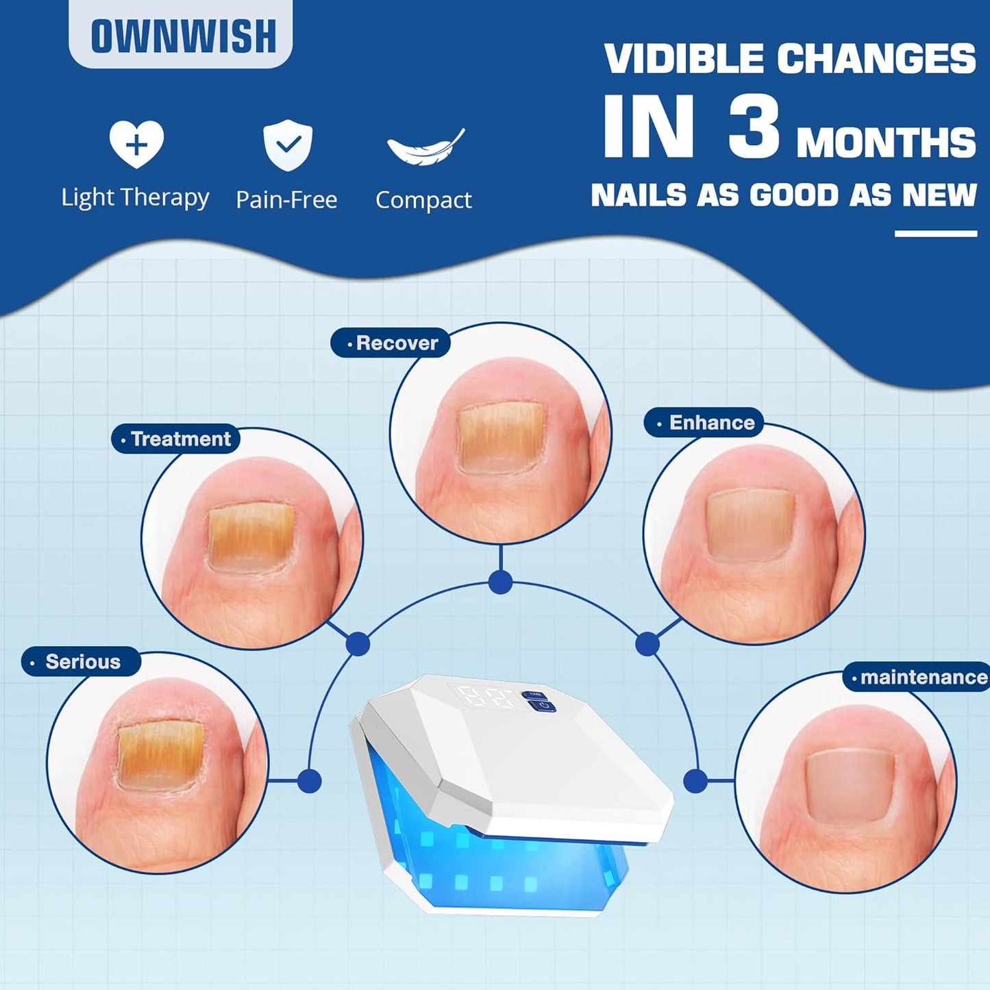 OwnWish Nail Fungus Cleaning Laser Device 905nm Infrared Light + 470nm Blue Light Highly Effective Treatment for Home Use Treat & Effectively Prevent (White)