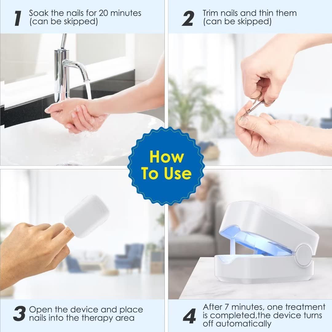 SUNCKY Nail Fungus Cleaning Laser Device, FSA or HSA eligible Nail Fungus Laser Treatment for Damaged Discolored Thick Toenails & Fingernails, Effective Rechargeable Nail Fungus Remover for Home Use