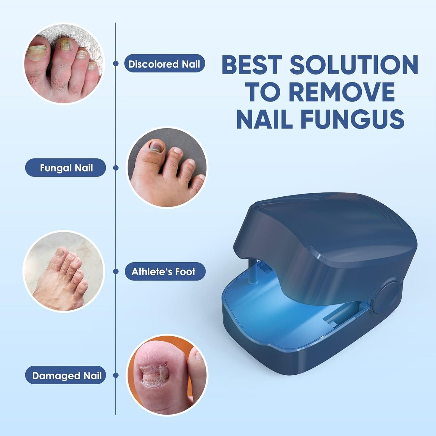 URMIIM Nail Laser Fungus Treatment Device, Nail Laser Cleaning Device for Fingernails and Toenails, FSA HSA Eligible Toenail Fungus Device for Home Use, Highly Effective Laser Treatment for Anytime