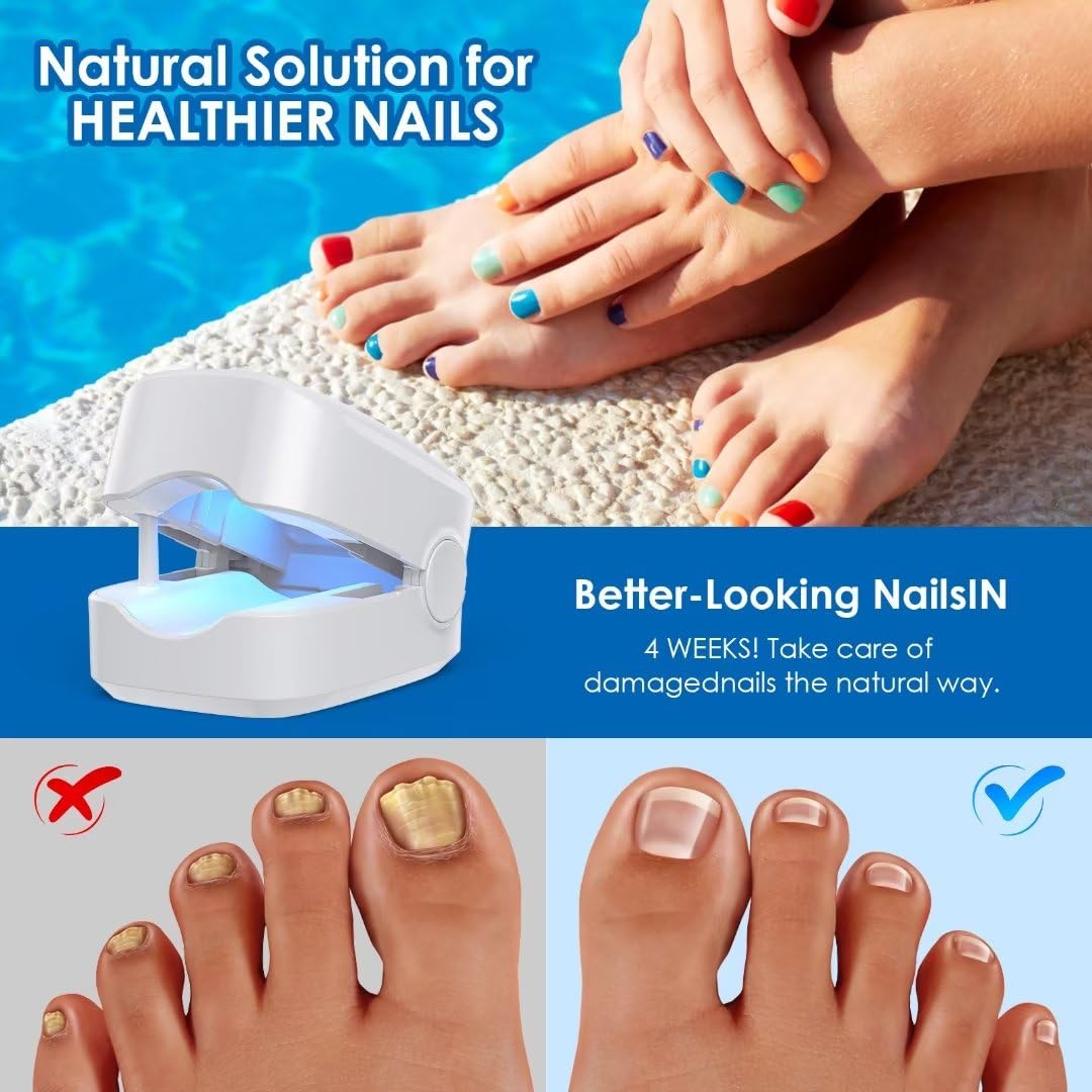 ZZP Nail Fungus Laser Treatment Device -Pain-Free, and Effective Home Treatment, No More Embarrassment