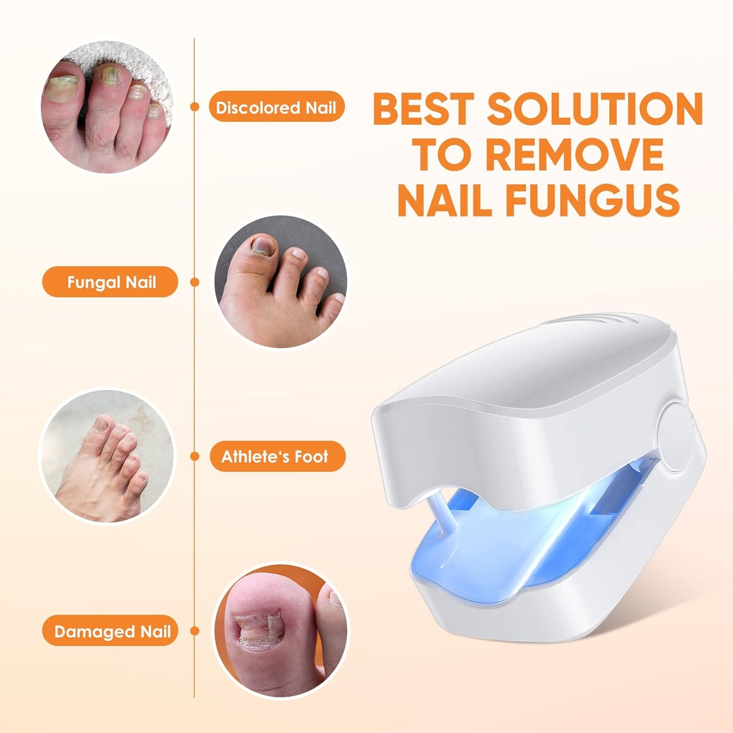 URMIIM Nail Fungus Cleaning Laser Device for Onychomycosis, Nail Fungus Laser Treatment for Fingernails and Toenails, Treatment for Home Use by 910nm Infrared Light + 470nm Blue Light, FSA HSA Eligible