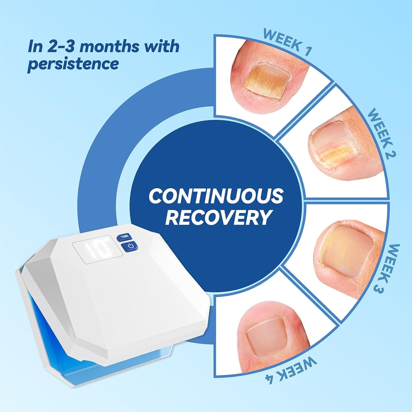VINECRO Nail Fungus Laser Device,Fit Multiple fingers or toes,Effective Nail Fungus Treatment for Toenails,Discolored and Thickened Toenails,Onychomycosis,Suitable for Home Use