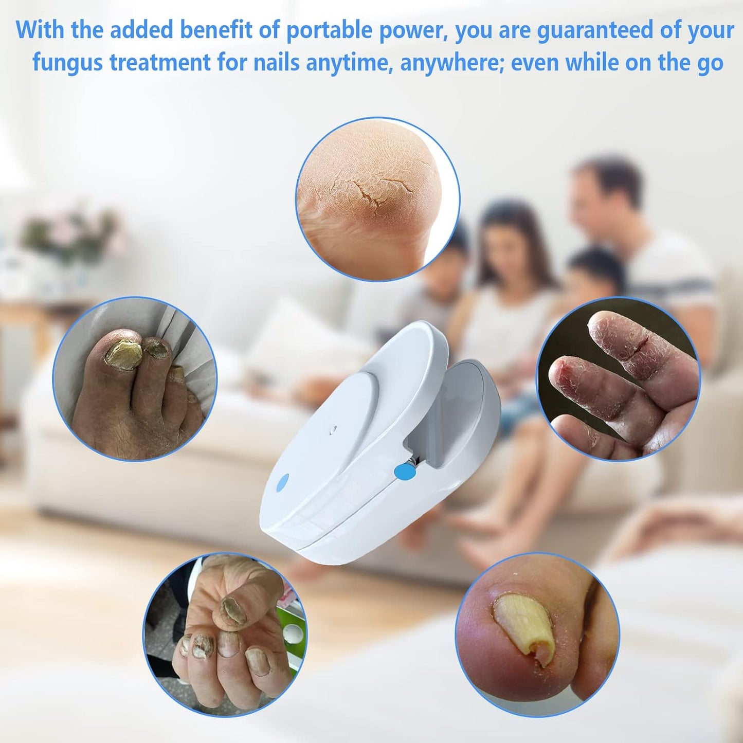 yiget Nail Fungus Cleaning LaserDevice for Onychomycosis, Revolutionary Home Use Nail-fungus Remover, Highly Effective Light Therapy for Fingernails and Toenails White