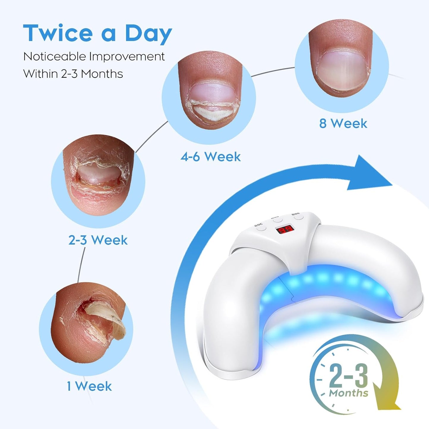 ZZP Nail Fungus Laser Treatment Device for Multiple Toenail, 905nm Infrared Light + 470nm Blue Light Toe Nail Fungus Device for Home Use, Highly Effective and Safe