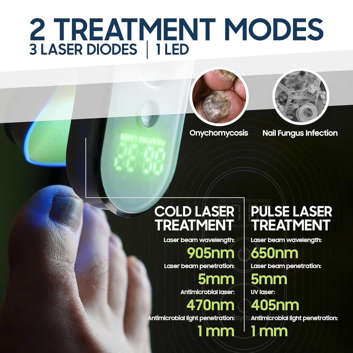 Onychom - Toenail Fungus Laser Treatment Device - Pain-Free Nail Fungus Treatment for Toenails and Fingernails - Includes Free Extra-Strength Antifungal Laser Enhancer Serum