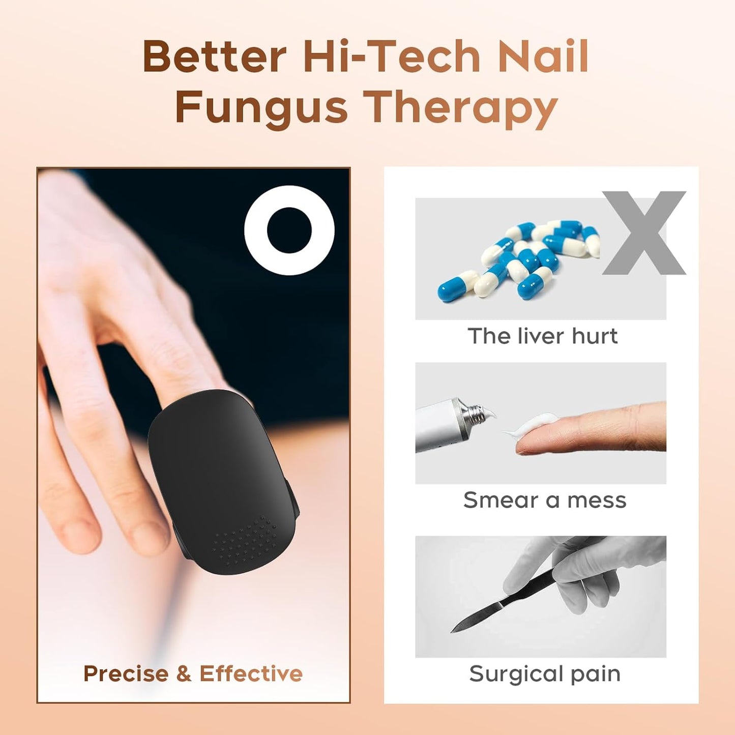 TPJOER Nail Fungus Laser Treatment Device, Home Use Laser Toenail Fungus Treatment Device, Elderly Easy to Use, Toenail Fungus Laser Onychomycosis Treatment, for Thickened and Yellowed Nails