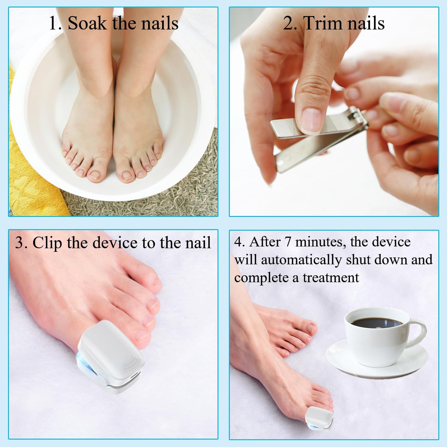 Secfanya Nail Fungus Cleaning Laser Treatment Device, Using 910nm Infrared and 470nm Blue Light, Effective Treatment of Damaged, Discolored, Thickened Toenails