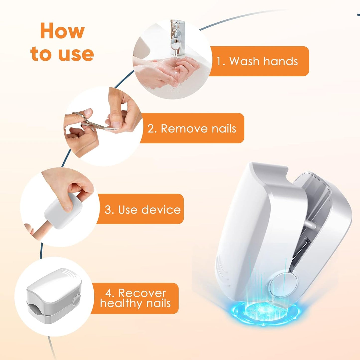 URMIIM Nail Fungus Cleaning Laser Device for Onychomycosis, Nail Fungus Laser Treatment for Fingernails and Toenails, Treatment for Home Use by 910nm Infrared Light + 470nm Blue Light, FSA HSA Eligible