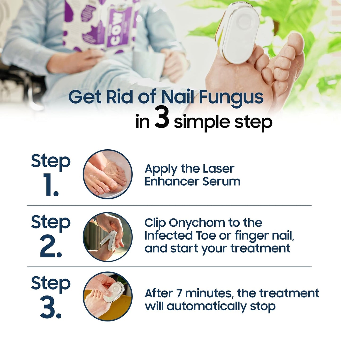Onychom - Toenail Fungus Laser Treatment Device - Pain-Free Nail Fungus Treatment for Toenails and Fingernails - Includes Free Extra-Strength Antifungal Laser Enhancer Serum