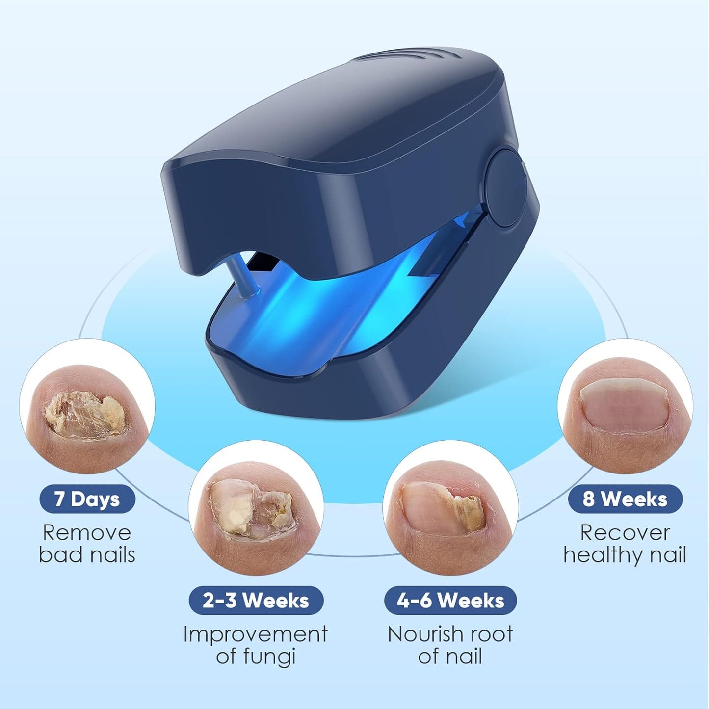 URMIIM Nail Laser Fungus Treatment Device, Nail Laser Cleaning Device for Fingernails and Toenails, FSA HSA Eligible Toenail Fungus Device for Home Use, Highly Effective Laser Treatment for Anytime