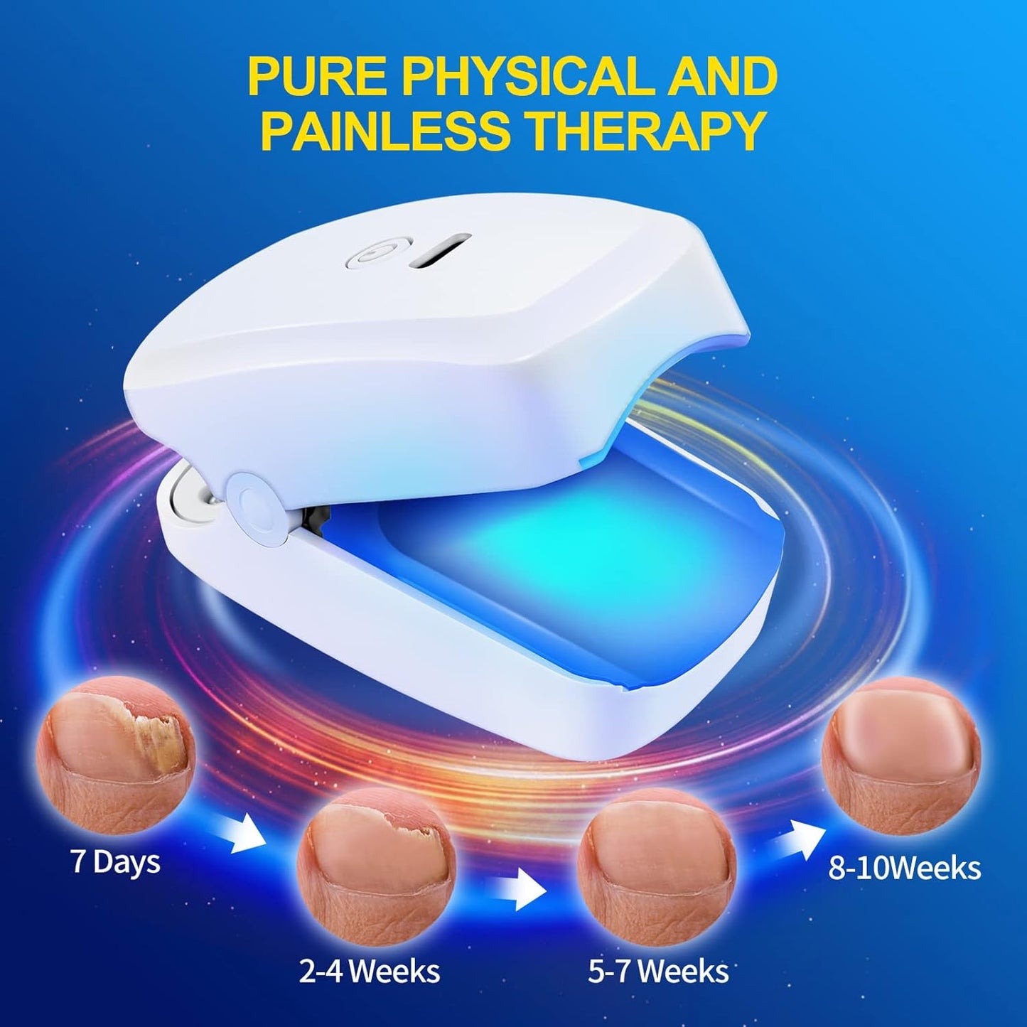 OKIO Nail Fungus Laser Treatment Device, Laser Device for Toenails Dermachom Nail Fungus Treatment Laser for Cleaning Onychom Laser Nail Treatment for Homeuse, Updated Toenail Fungus Laser White