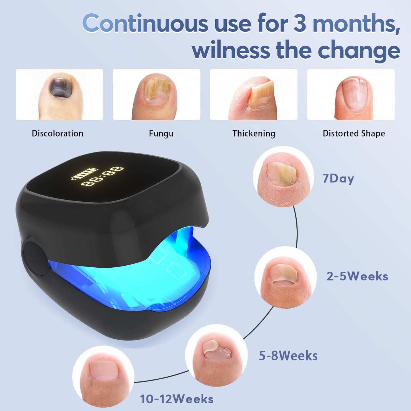 Nail Fungus Laser Treatment Led Light Device - B0DTHCRQFR