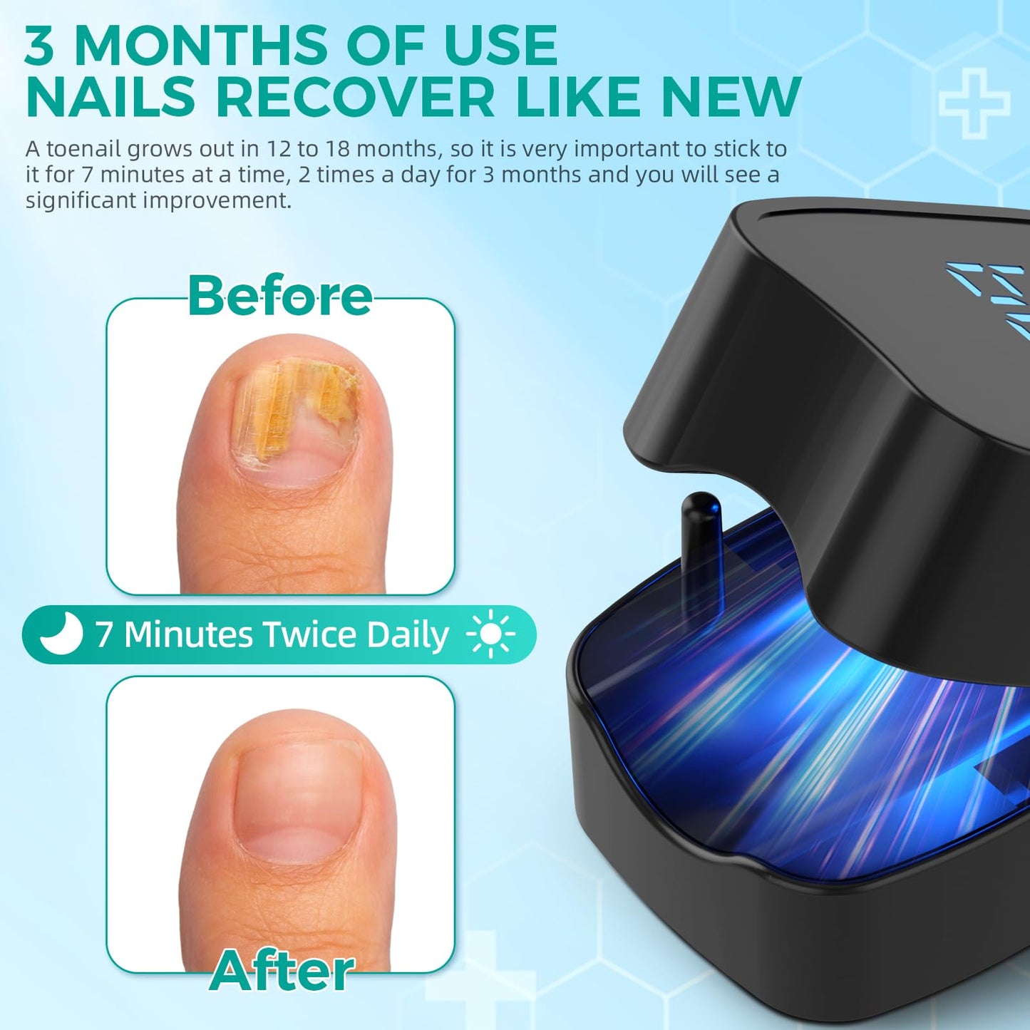 Nail Fungus Laser Treatment LED Light Device-B0DFQ7TWBL