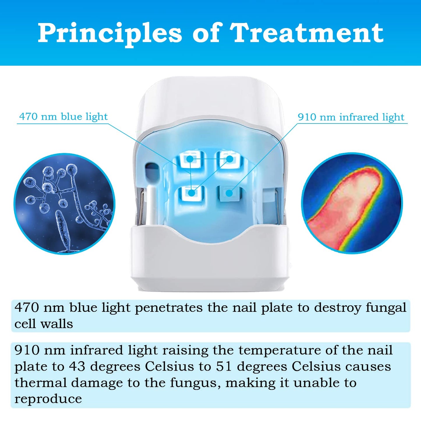 BEPHON Nail Fungus Cleaning Laser Treatment Device - Effective Home-Use Therapy for Damaged, Discolored, and Thickened Toenails and Fingernails with 910nm Infrared and 470nm Blue Light