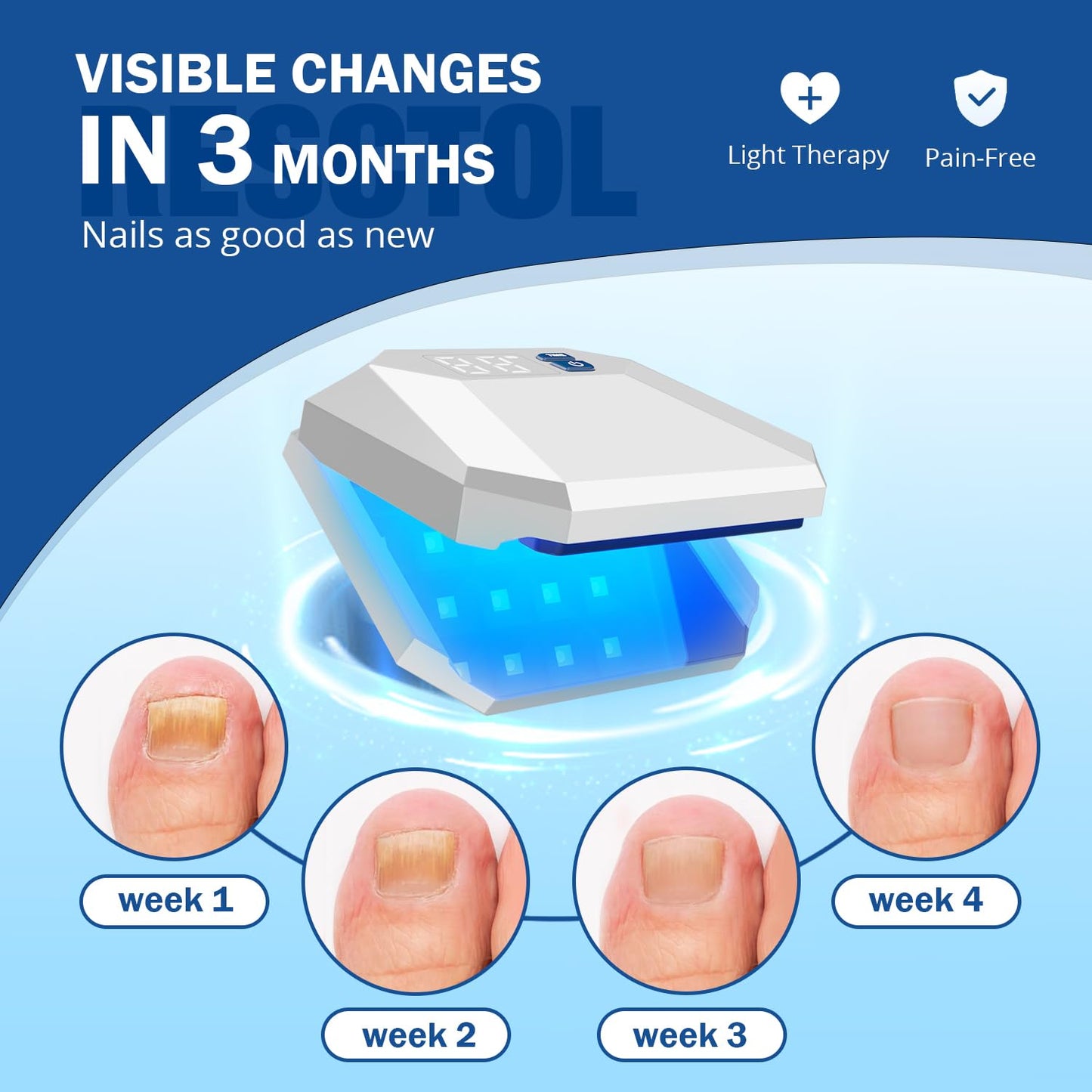 JNCHOICE Nail Fungus Cleaning Laser Device for Multiple fingers 905nm Infrared Light + 470nm Blue Light Highly Effective Treatment for Home Use Treat and effectively prevent