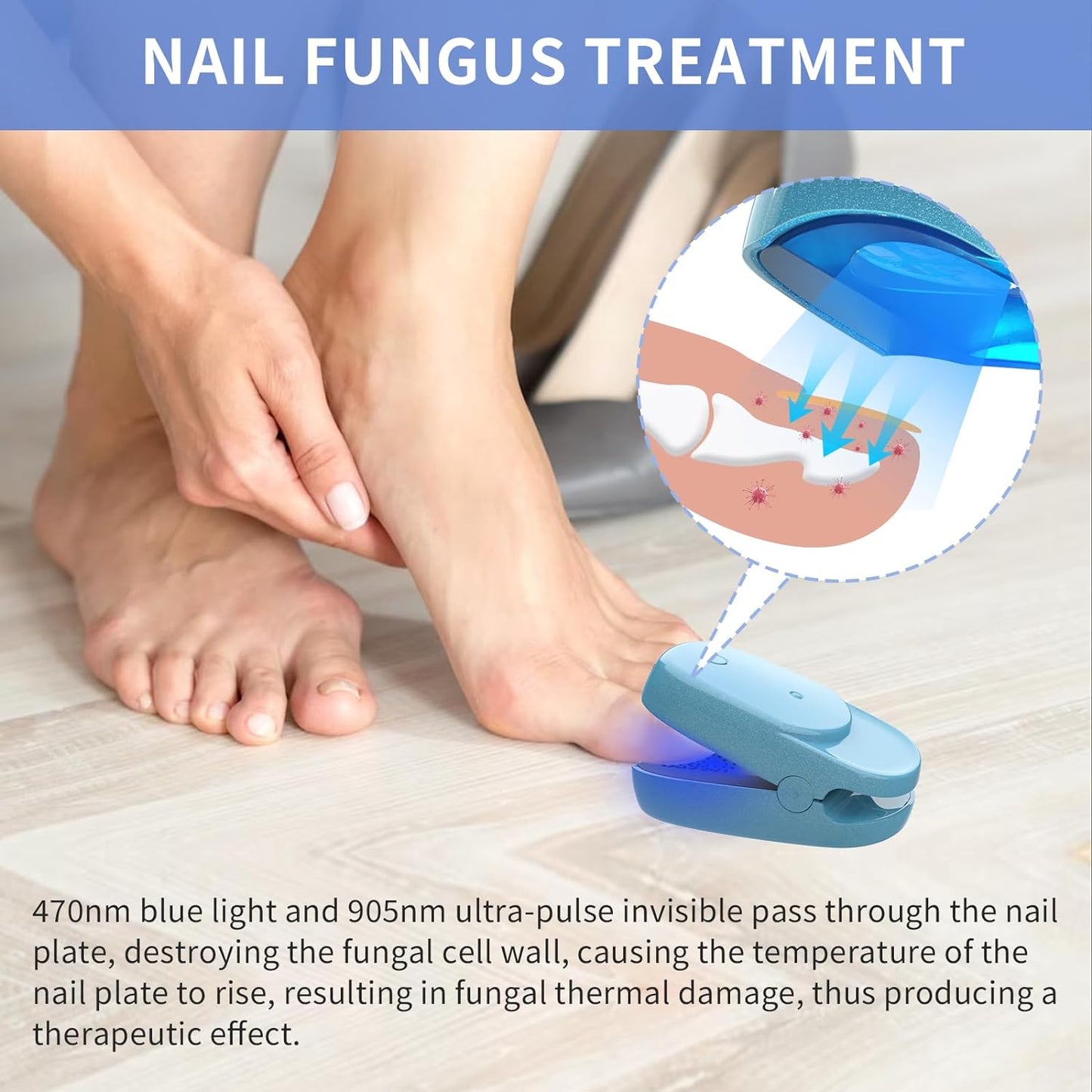 LaseLocks Nail Fungus Laser Treatment Device,Nail Cleaning Laser Device Onychom Laser Nail Treatment for Damaged, Discolored, and Thickened Toenails & Fingernails