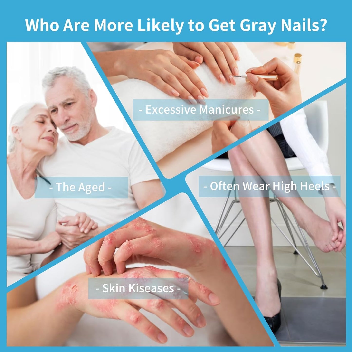 KTS Nail Fungus Laser Treatment Device,Onychom Laser Nail Treatment,Nail Fungus Treatment for Toenails,Targets Damaged, Discolored and Thickened Toenails