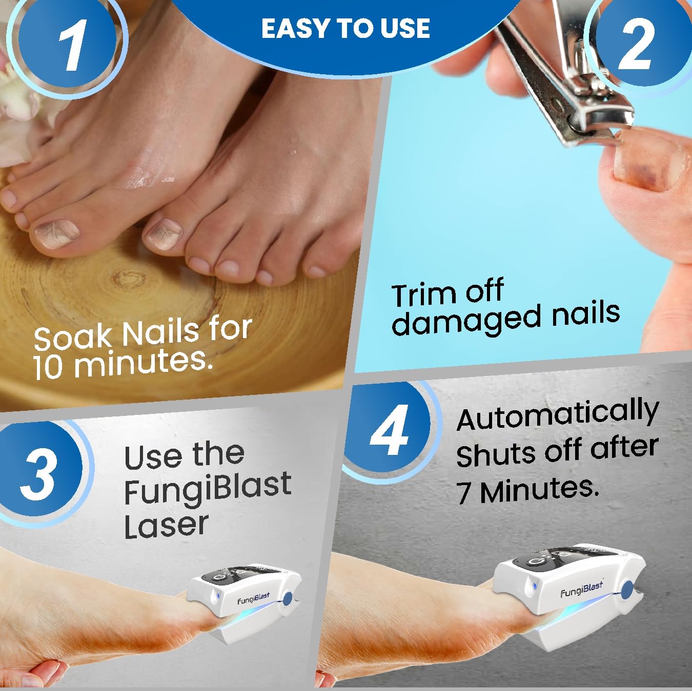 FungiBlast Nail Fungus Laser Treatment Device - Onychomycosis Laser Nail Treatment - Effective | Safe | Rechargeable home Laser Treatment for Damaged Discolored Unattractive Nails