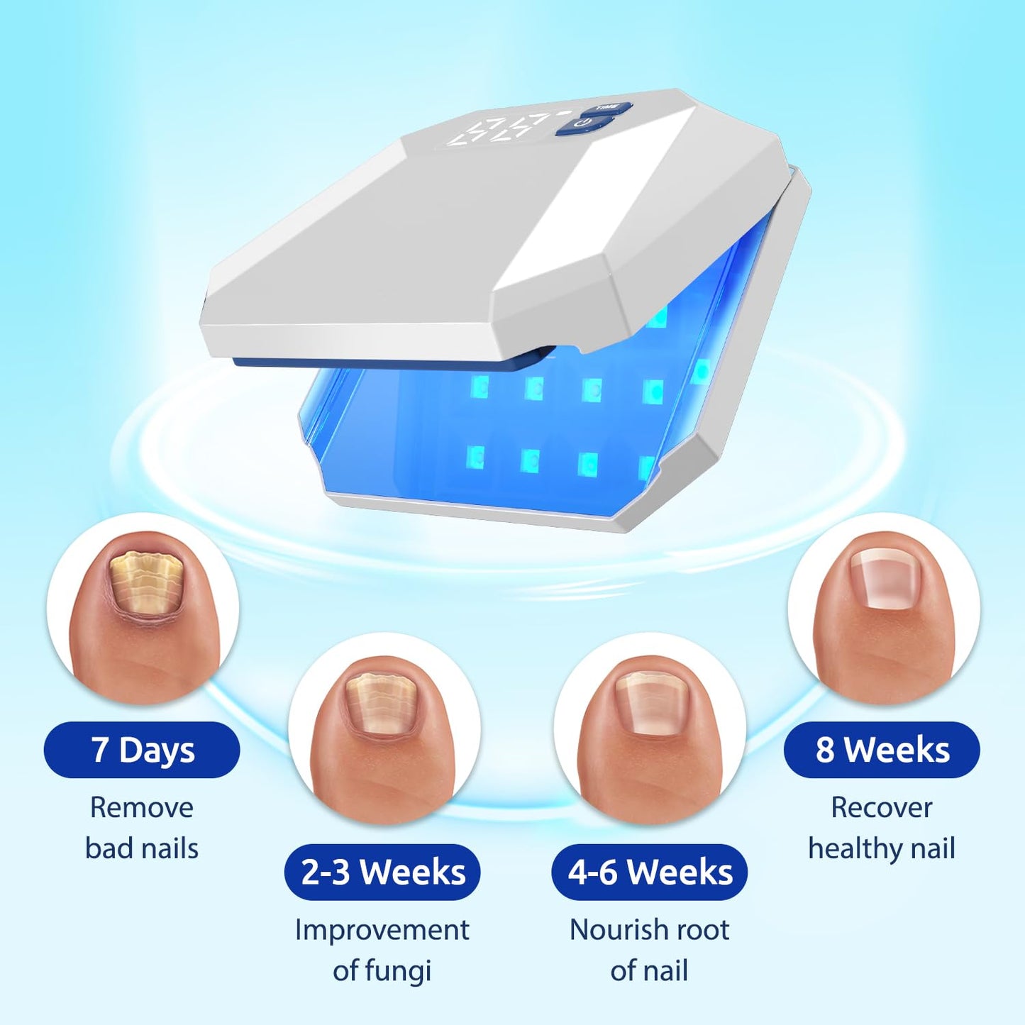 Mimoment Nail Fungus Cleaning Laser Device for Onychomycosis, Nail Fungus Laser Treatment for Fingernails, Effective Convenient Toenail Nail Fungus Treatment for Home Use