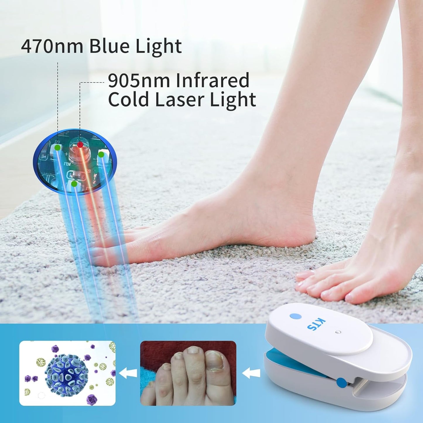 KTS Nail Fungus Laser Treatment Device,Onychom Laser Nail Treatment,Nail Fungus Treatment for Toenails,Targets Damaged, Discolored and Thickened Toenails