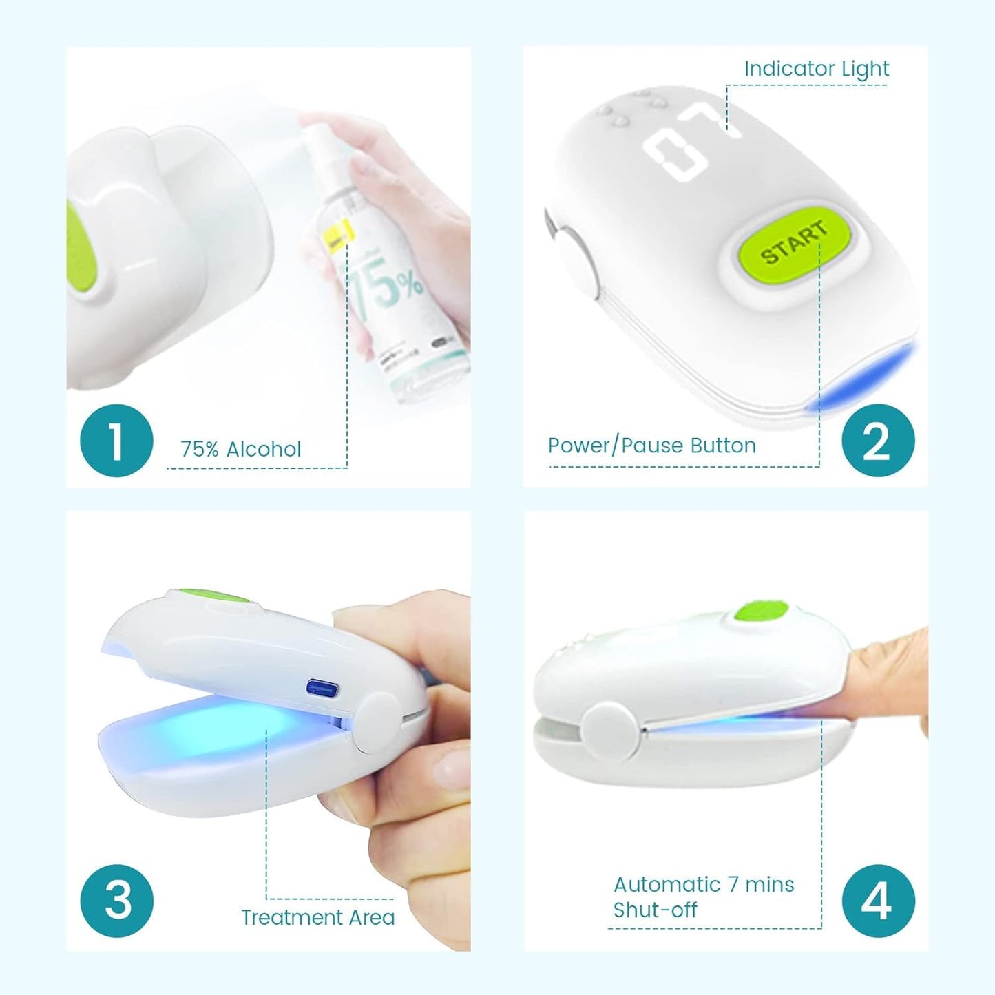 BETISBE Nail Fungus Cleaning LaserDevice for Onychomycosis, Revolutionary Home Use Nail-fungus Remover, Upgraded Highly Effective Treatment Device, Improving the Health of Unsightly Nails for Fingernails