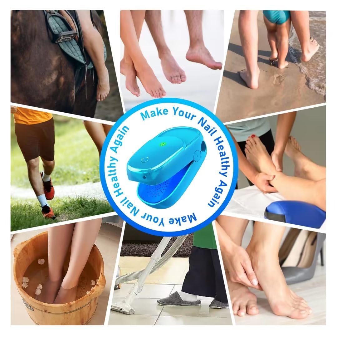 Jitesy Nail Fungus Laser Treatment, Onychom Laser Cleaning Device for Fingernails and Toenails, Toenail Fungus Treatment for Home Use