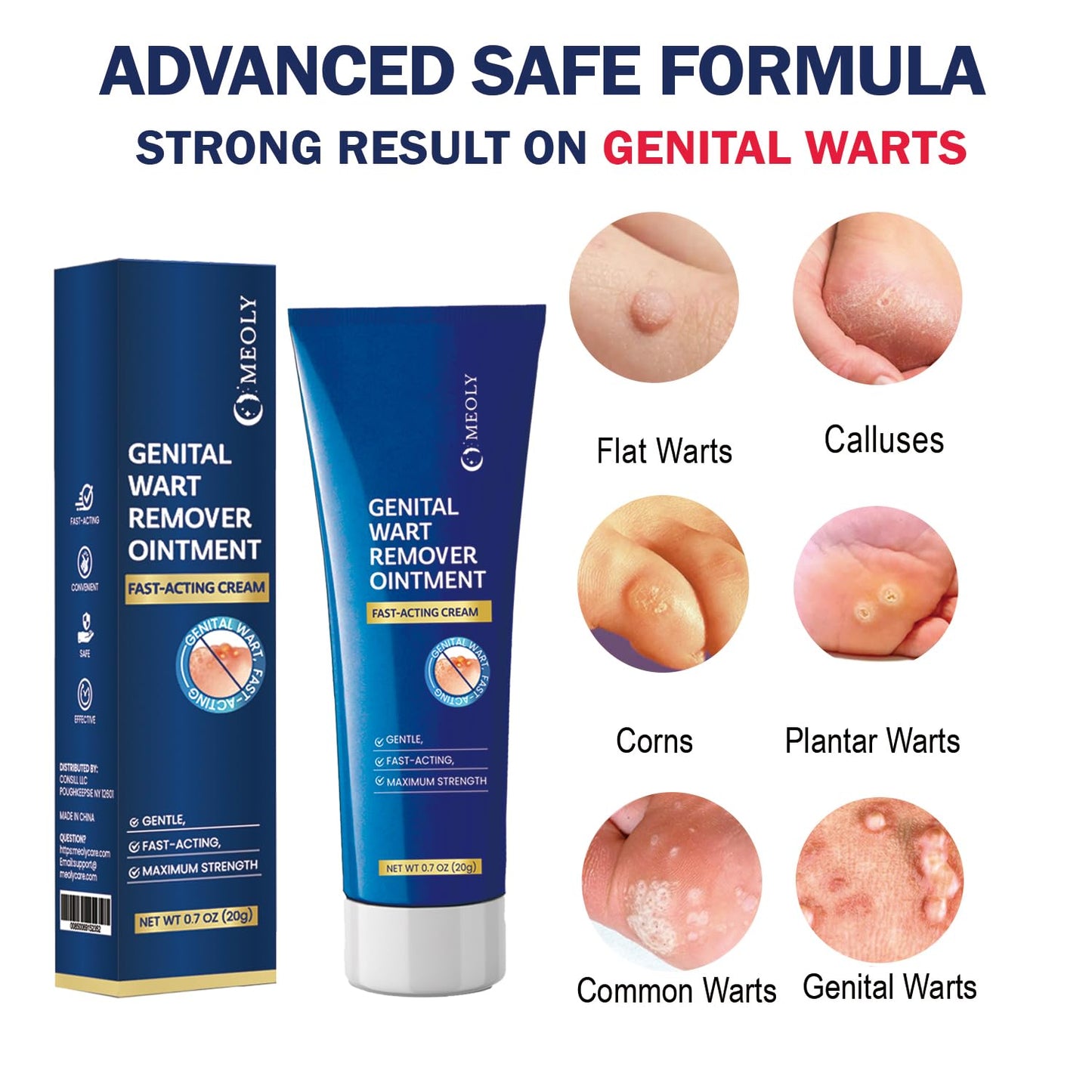 Genital Wart Remover Cream: Genital Wart Removal Ointment with Salicylic Acid Fast-Acting, Gentle for Men and Women