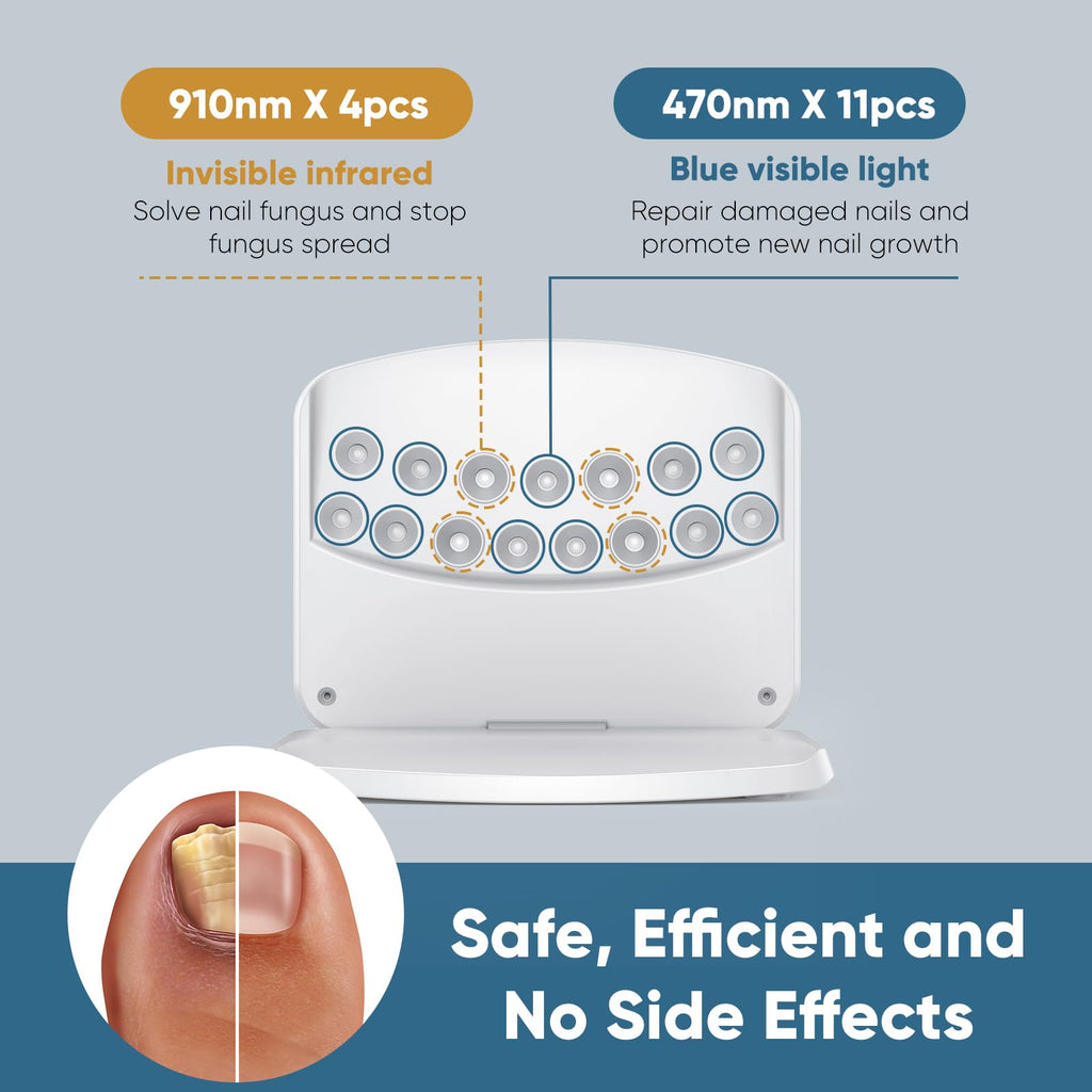 Dispositivo laser micosi unghie piede, dispositivo per funghi unghie, 15 LED (11 luce blu + 4 infrarossa invisibile), ricaricabile USB-C, timer touch 5/10/15/20 min, uso casa e viaggio-Bianco