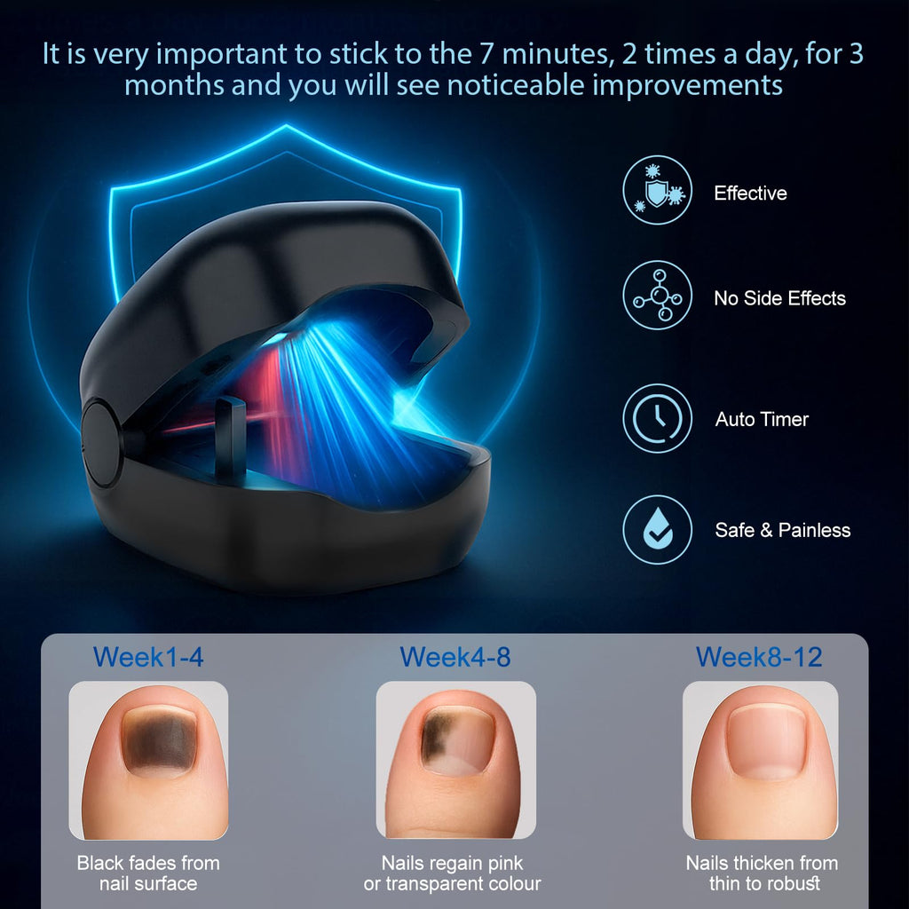 Nail Fungus Laser Treatment LED Light Device - Toenail Fungus Treatment, Solution for Fungal Infections, Nail Deformation and Painful Walking, Black