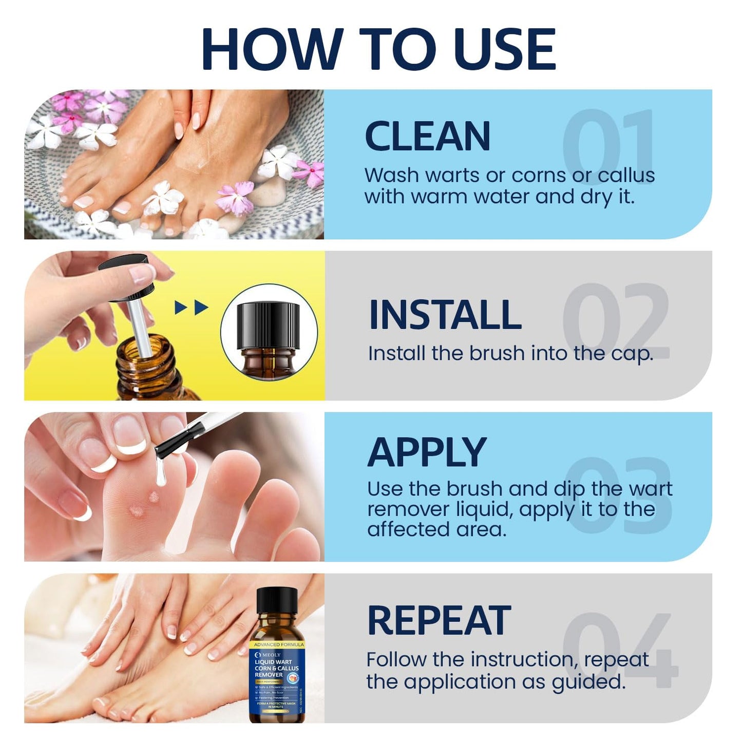 Fast-Acting Wart Remover Freeze Off : Salicylic Acid Wart Remover for Plantar Wart, Corn Freeze Off Fast-Acting for Men and Women 30 ML