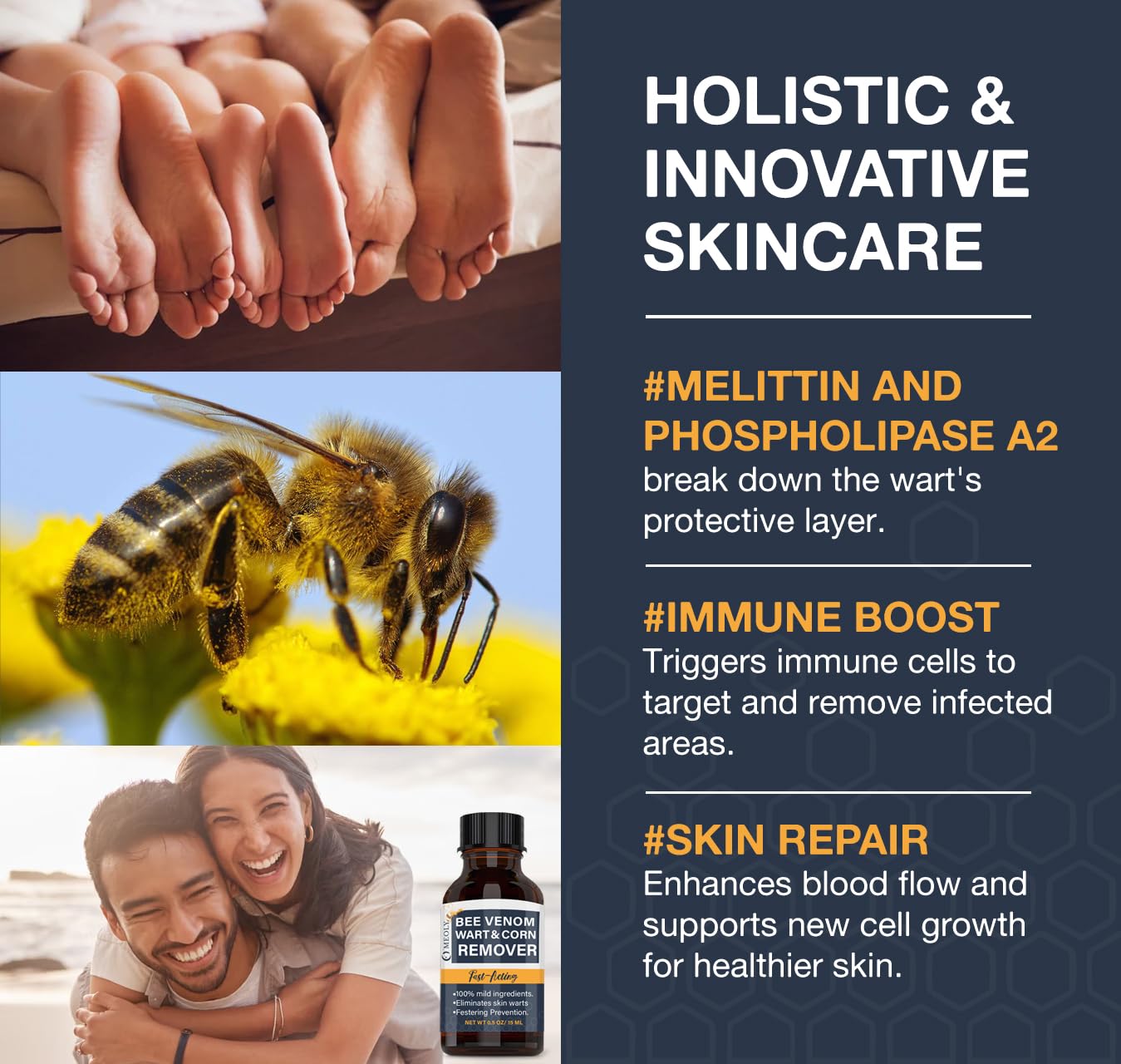 Bee Venom Skin Wart Remover: Fast-Acting 20% salicylic Acid Skin Wart Remover for Plantar Wart, Genital Wart