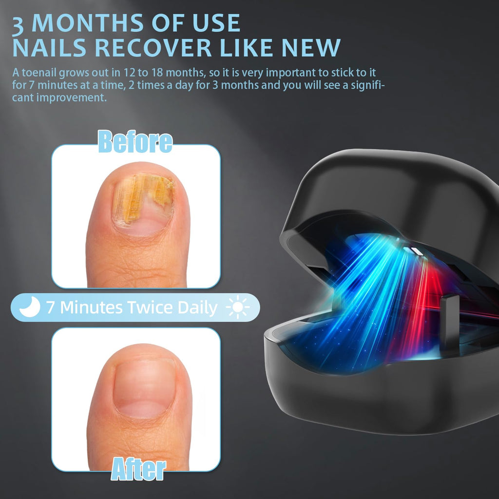Nail Fungus Laser Treatment LED Light Device - Toenail Fungus Treatment, Solution for Fungal Infections, Nail Deformation and Painful Walking, Black