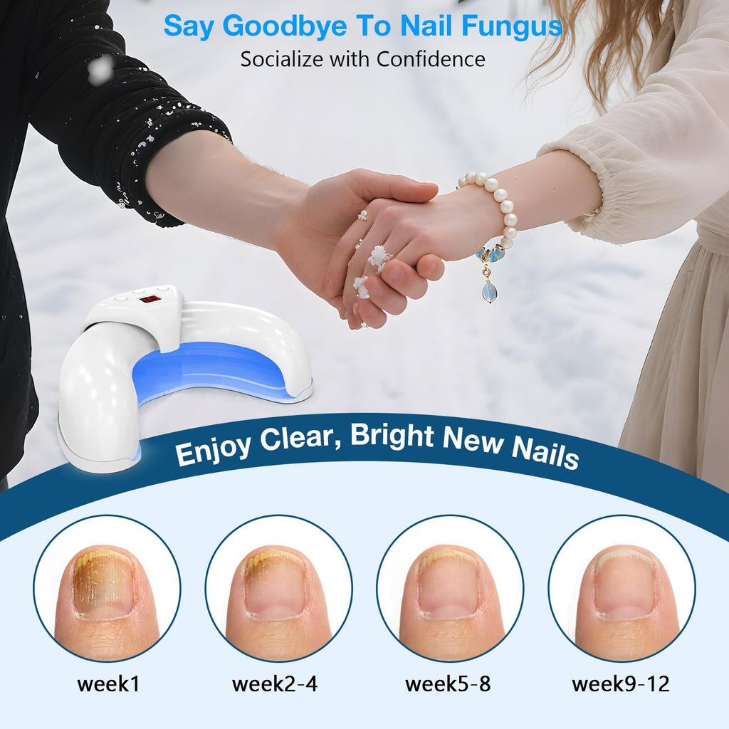 Nagelpilz Laser Gerät, Berrlly Nagelpilz Laser Device Verwendung für Mehrere Fingernägel und Zehennägel, Einfach zu Bedienendes Faltbares Gerät, Geeignet für Verfärbte und Verdickte Zehennägel