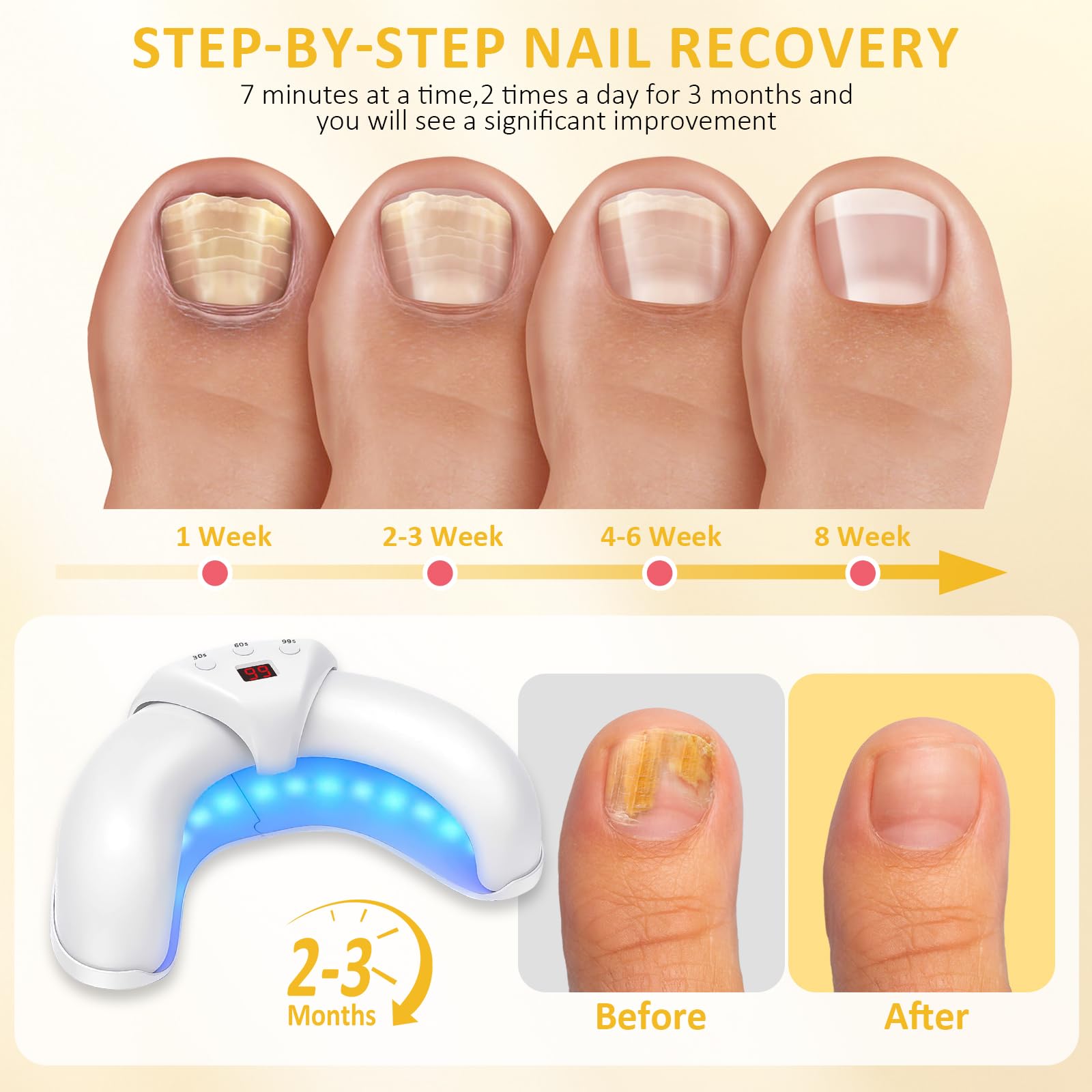 Nail Fungus Laser Treatment LED Light Device, Nail Fungus Cleaning Light Device for Damaged, Thick Toenails and Fingernails, Suitable for Home Use (White)