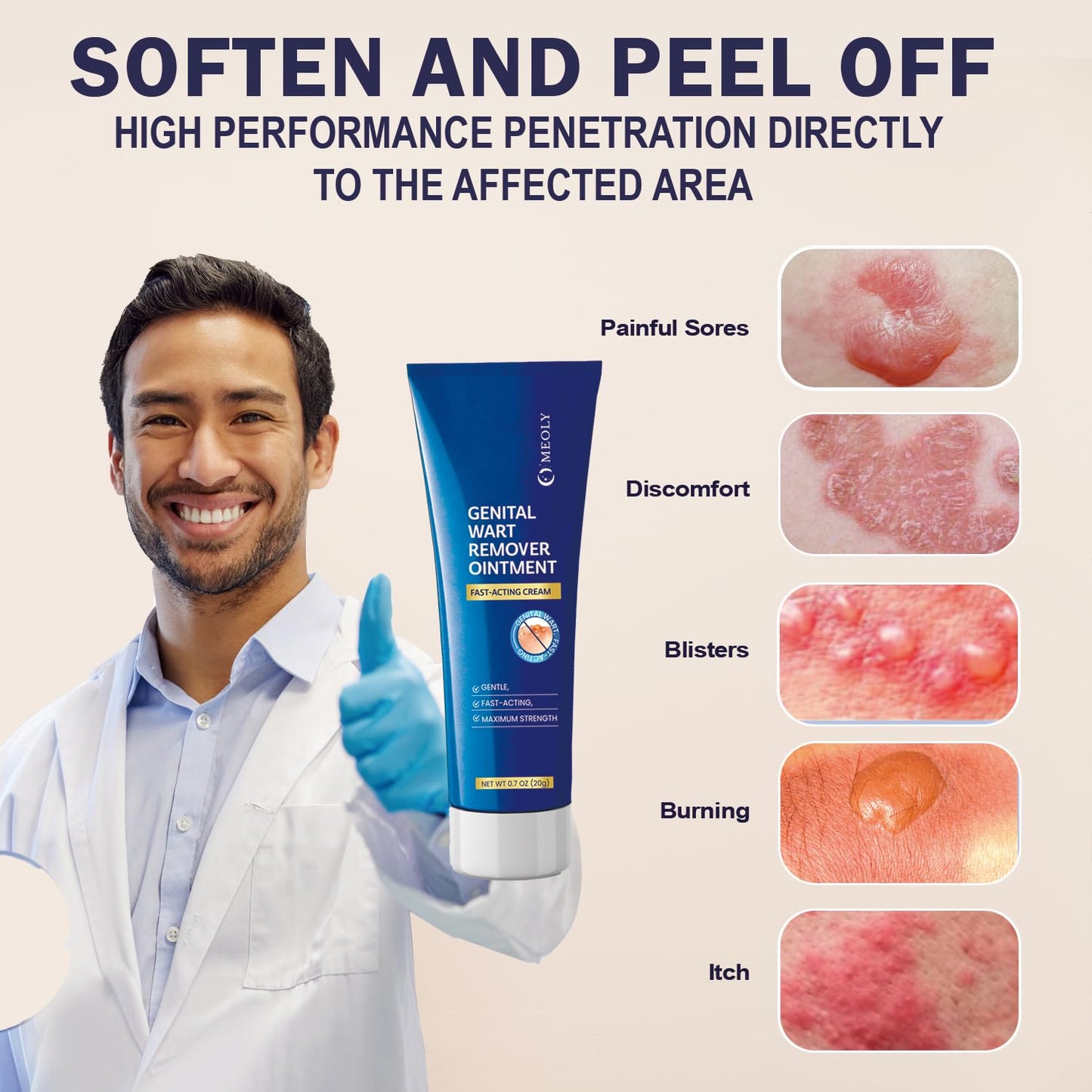 Genital Wart Remover Cream: Genital Wart Removal Ointment with Salicylic Acid Fast-Acting, Gentle for Men and Women