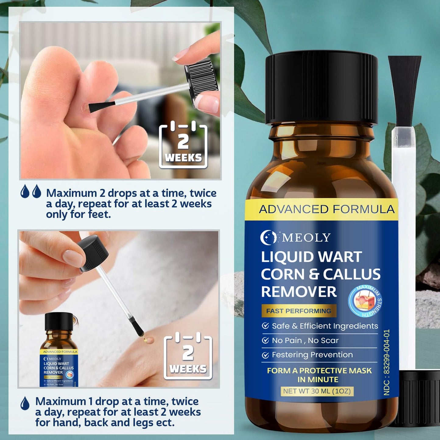 Fast-Acting Wart Remover Freeze Off : Salicylic Acid Wart Remover for Plantar Wart, Corn Freeze Off Fast-Acting for Men and Women 30 ML