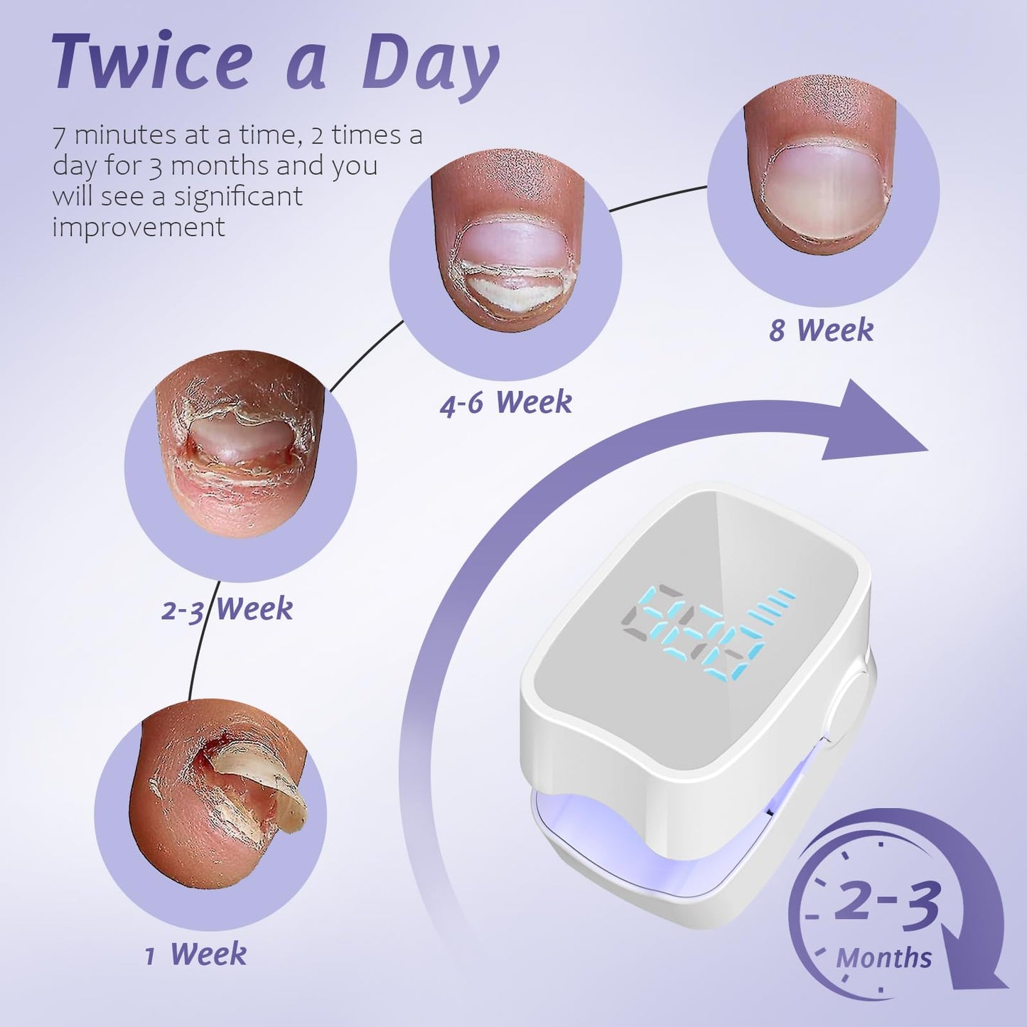 Nail Fungus Laser Treatment LED Light Device