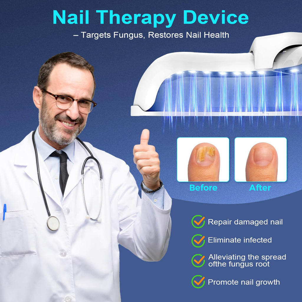 Nail Fungus Laser Treatment LED Light Device-Portable Design,Suitable For Fingernails And Toenails White 2 Fl Oz (Pack of 1)