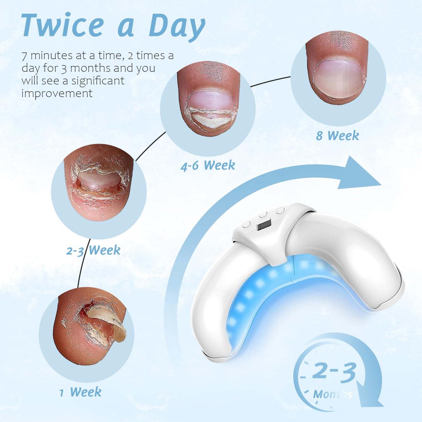 Nail Fungus Laser Treatment LED Light Device