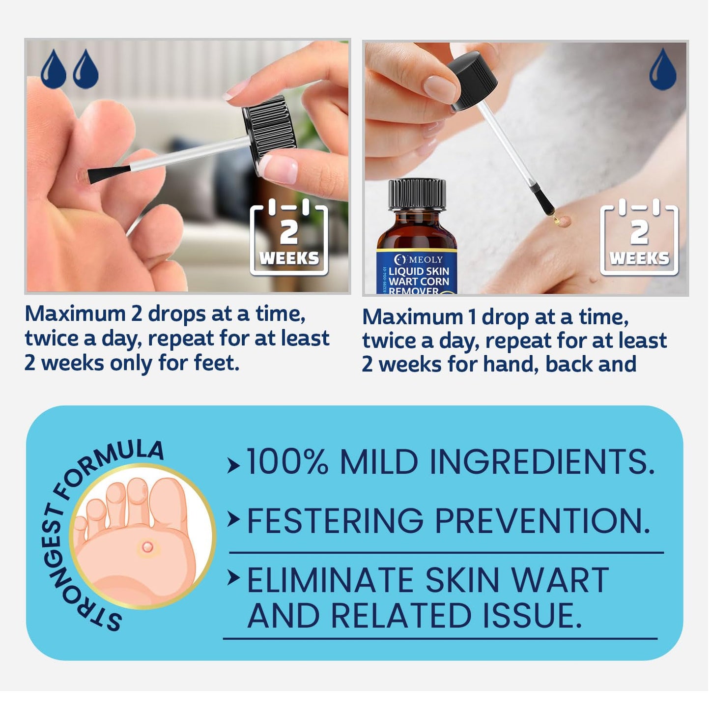 Fast-Acting Wart Remover: 40% Salicylic Acid Wart Remover Maximum Strength for Plantar Wart, Corn Men and Women